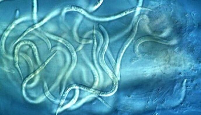як виглядають паразити нематоди в організмі людини