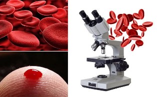 гемосканірованіе крові